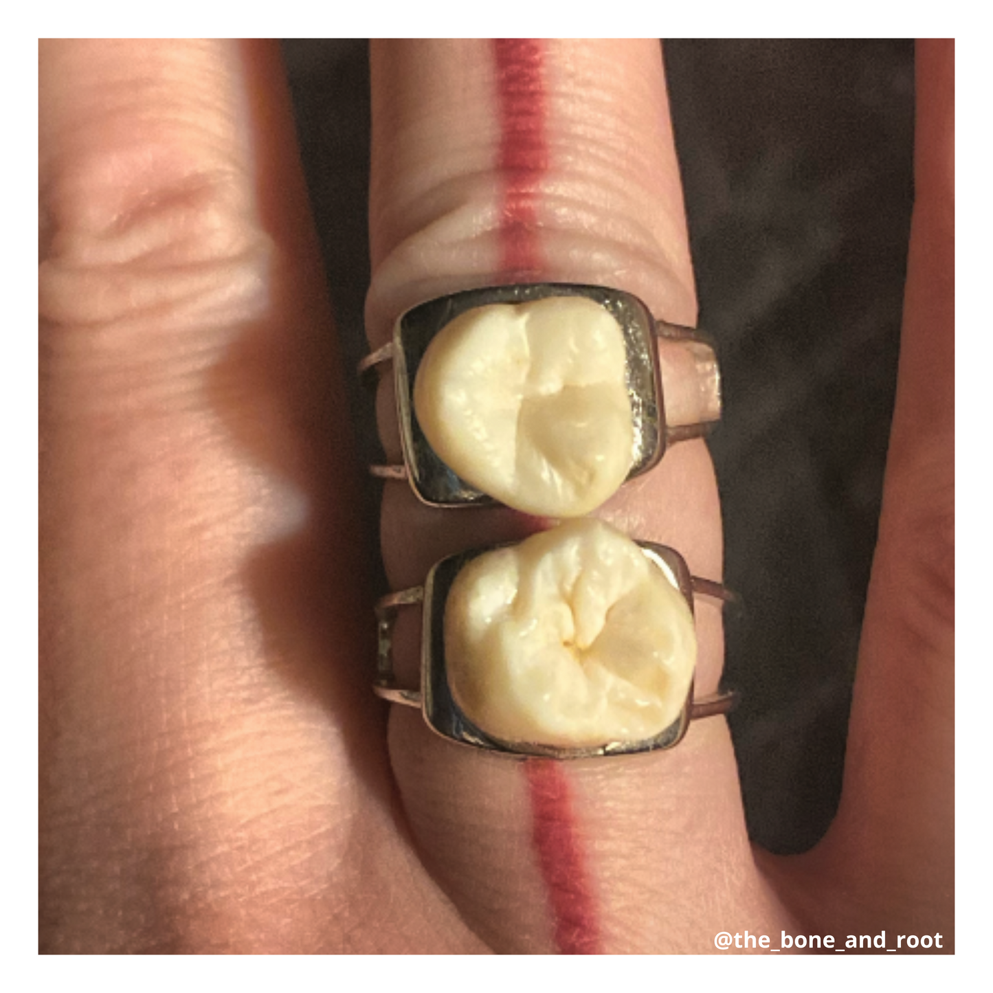 Authentic Human Teeth Sterling Silver Ring