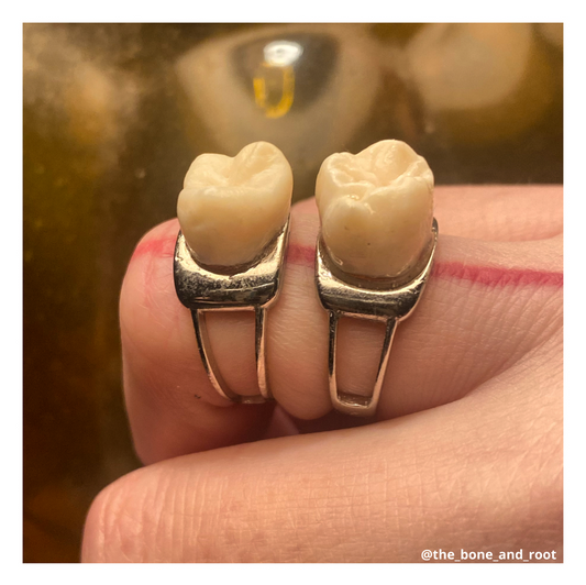 Authentic Human Teeth Sterling Silver Ring